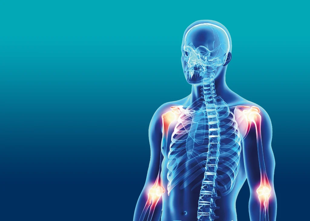 Skeleton illustration showing highlighted red glowing areas around joints to indicate arthritis pain.